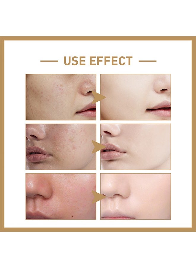 Rice Toner, 77.78% Rice Extract, Effectively Replenish Nutrients Improve Dryness Soften Cuticles Minimize Poreslighten Acne Scars Soothe And Repair Skin 150ML