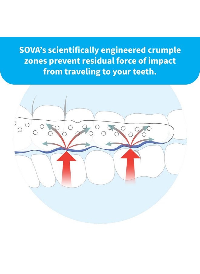 SOVA Aero Night Guard - 1.6mm Thin - Custom-Molded Fit - Protects Against Nighttime Teeth Grinding & Clenching - FSA/HSA Eligible - Odor & Taste Free - Remoldable Up to 20 Times - Non Toxic