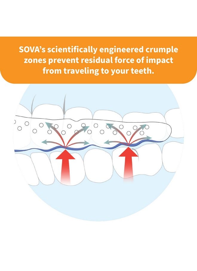 SOVA Junior Night Guard, Purple Punch - 1.6mm Thin - Custom-Molded Fit - Protects Against Nighttime Teeth Grinding & Clenching - FSA/HSA Eligible - Odor & Taste Free - Remoldable Up to 20 Times