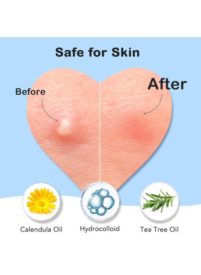 Pimple Patches for Face 7 Sizes Day and Night Acne Patches Heart Zit Patches Cute Spot Stickers with Tea Tree & Centella Oil, Strong Adhesion Zit Covers (412 Count)