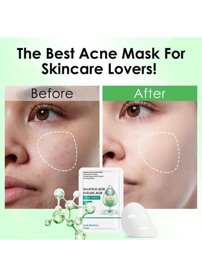 IREV Anti Acne Face Mask,Sheet Masks With Salicylic Acid, Face Masks Skincare For Acne, Acne Sheet Mask for Acne-Prone, Oily, and Sensitive Skin, Deep Pore Cleansing Facial Mask 10 Sheets