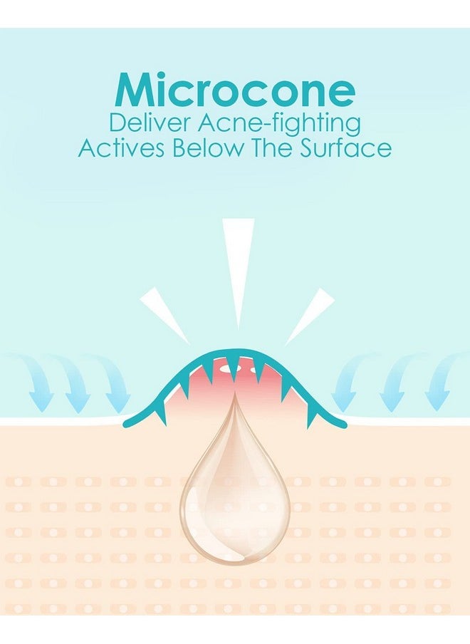 +1HEROLABS Microdart Acne Patch (54 Patches), Hydrocolloid Pimple Patches, Zit Patches, Pimple Patches for Face Salicylic Acid, Blemish Patches for Early Stage Deep Pimples (54 Count (Pack of 1))