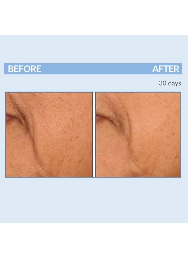 Serious Skincare A Defiance - Vitamin A Retinol Treatment Pads - Anti-Aging for Lines, Wrinkles, Dark Spots - Skin Resurfacing Cushions for Facial Radiance - 60 Count