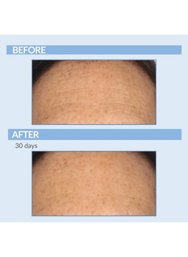 Serious Skincare A Defiance - Vitamin A Retinol Treatment Pads - Anti-Aging for Lines, Wrinkles, Dark Spots - Skin Resurfacing Cushions for Facial Radiance - 60 Count