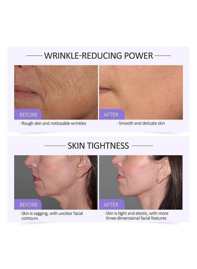 Collagen Serum For Face, Collagen Face Serum For Skin Tightening Helps Lift, Plump, & Firm Sagging Skin, Serums For Skin Care, Anti Wrinkle 1.35 Fl Oz