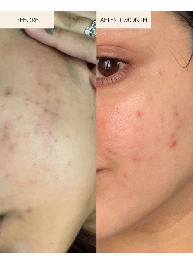 MARA - Natural Chlorella + Reishi Sea Vitamin C Serum | Plant-Based Skin Care | Skin Firming With Moringa + Squalane (0.5 oz | 15 ml)