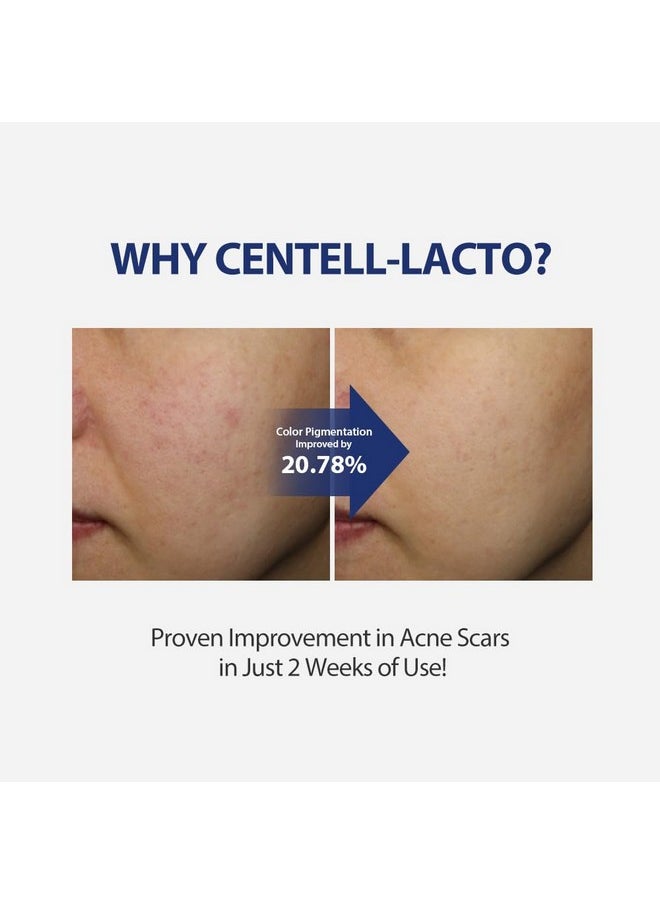 SUNGBOON EDITOR Centell Lacto AC Less Skin Barrier Essence Serum | Acne Treatment for Face | Probiotics Skin Care for Sensitive Skin | Niacinamide Hydrating Face Serum | Korean Skin Care