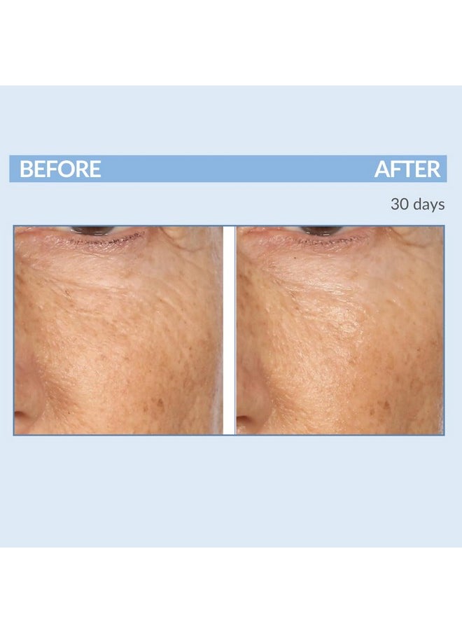 Serious Skincare Retinol Facial Care DUO - A Force XR Serum Concentrate & A Cream XR Moisture Cream for Face - With Vitamin C - Anti-Aging for Lines, Wrinkles - Resurfaces and Hydrates Skin