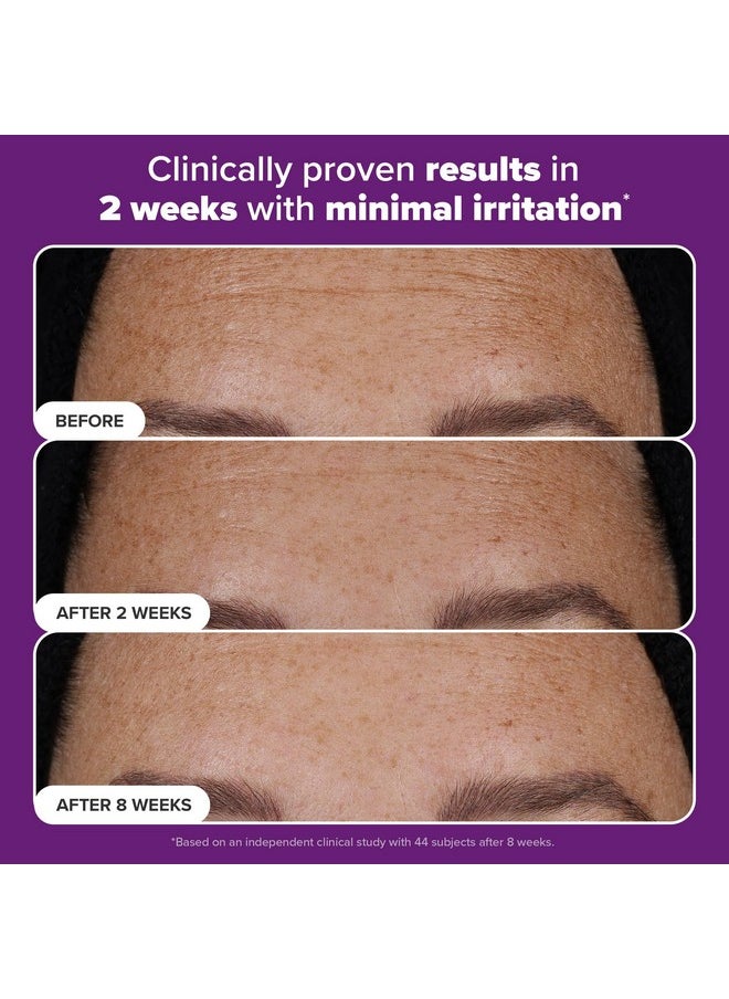 Paula’s Choice Pro Retinaldehyde Dual-Retinoid Advanced Treatment, High Potency Anti-Aging Serum for Breakout-Prone Skin, Radiance & Rough, Bumpy Texture, Fragrance-Free, 1 Fl. Oz.