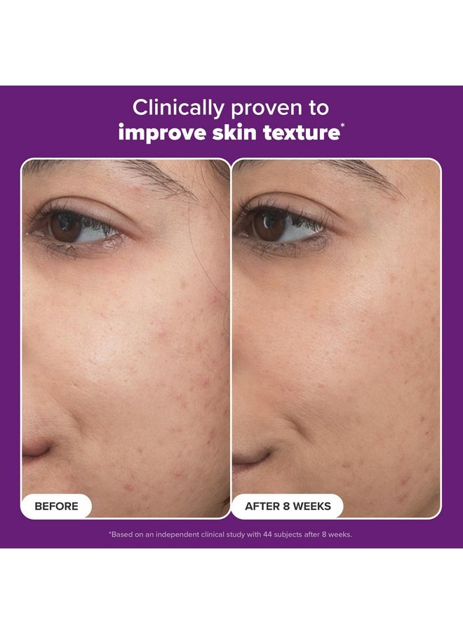 Paula’s Choice Pro Retinaldehyde Dual-Retinoid Advanced Treatment, High Potency Anti-Aging Serum for Breakout-Prone Skin, Radiance & Rough, Bumpy Texture, Fragrance-Free, 1 Fl. Oz.