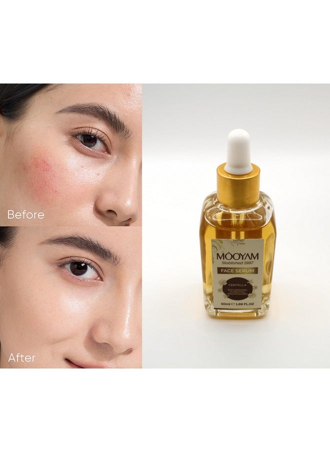 Face Serum for Skin Care | Hydrating | Smoothening - Pack of 1