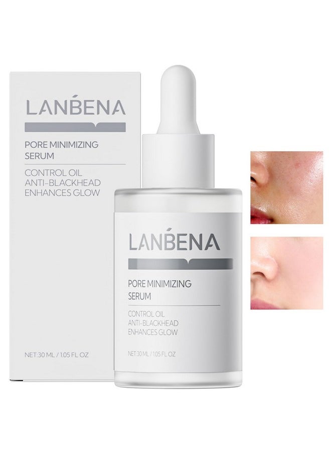 LANBENA Pore Minimizer for face, Skin Care, Pore Minimizer Treatment Serum 2.0, Facial Essence for Shrinking Pores, Relieving Dryness, Oil Control Firming, Moisturizing after Remover Blackhead, 30ML
