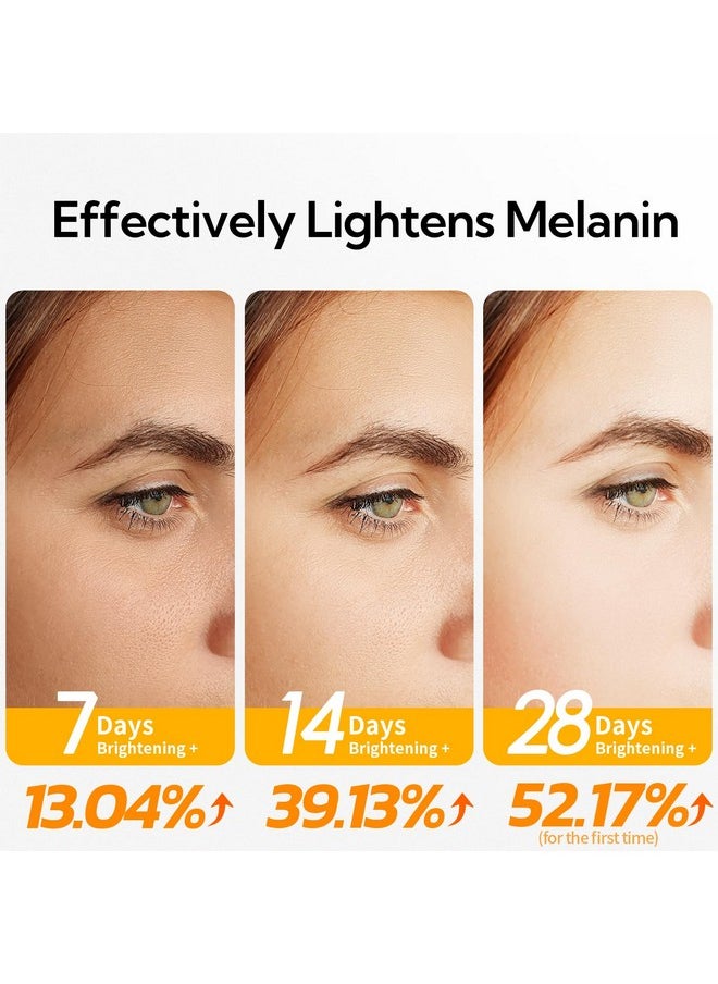 20% Vitamin C Serum For Face, 30 ML/ 1 Fl, Brightening Skin, Dark Spot Remover, Reduce Wrinkle, Anti Aging Glowing Serum, Facial Moisturizer with Niacinamide, Vitamin E, Hyaluronic Acid