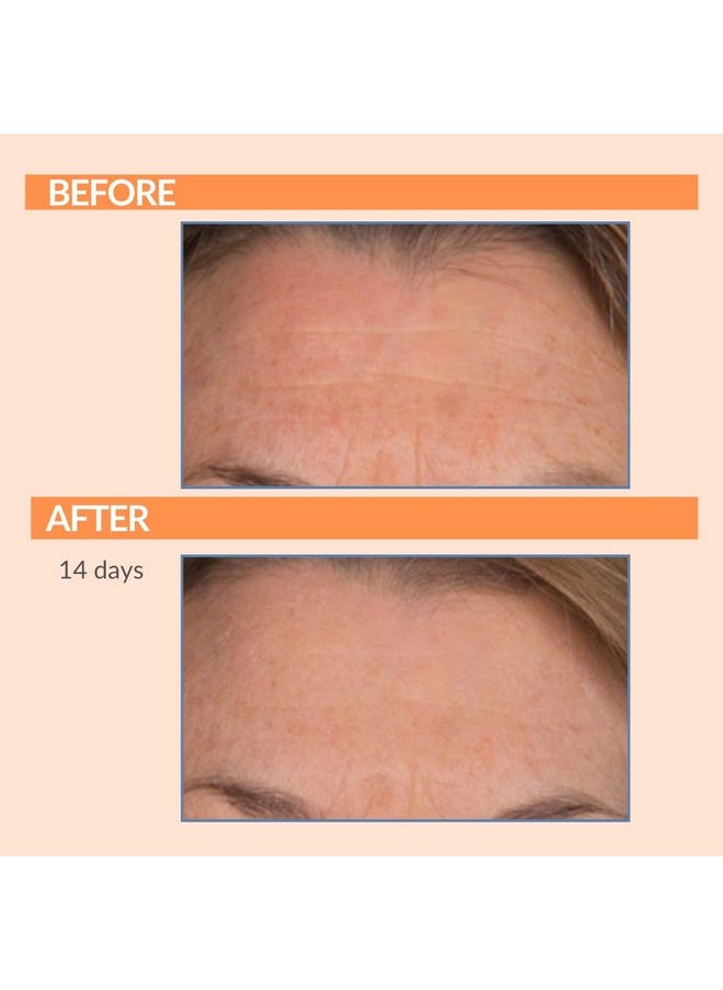 Serious Skincare - Vitamin C Day & Night Skin Care Set - Brightening Face Serum, Daytime SPF Moisturizer, Restore Night Cream, Face Wash - C3 C Esters for Hydrating, Fine Lines and Wrinkles (4Pack)