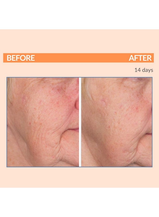 Serious Skincare - Vitamin C Day & Night Skin Care Set - Brightening Face Serum, Daytime SPF Moisturizer, Restore Night Cream, Face Wash - C3 C Esters for Hydrating, Fine Lines and Wrinkles (4Pack)