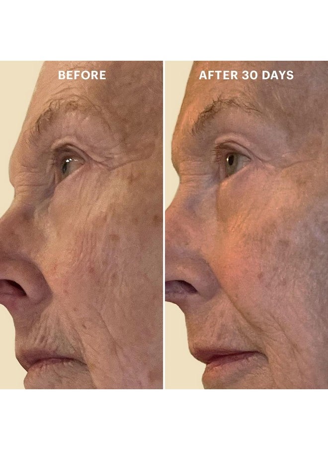 Glo Skin Beauty Bio-Renew EGF Eye Cream - Epidermal Growth Factor Cell Repairing Eye Cream, Combats Signs of Aging By Repairing, Hydrating & Firming Skin