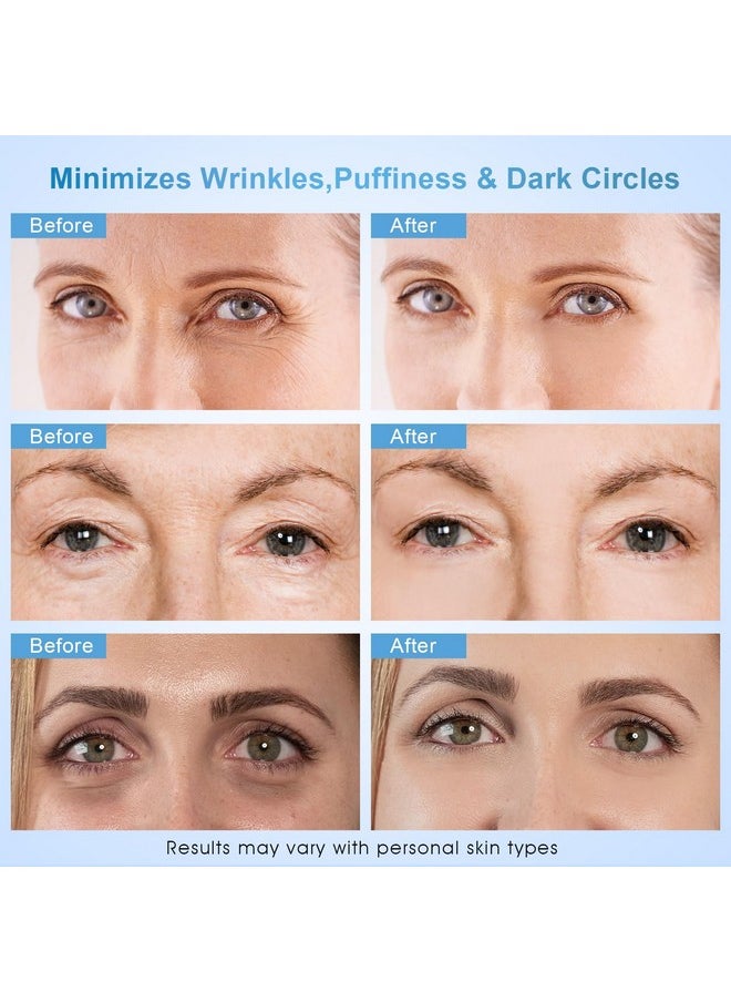 Dongyu Anti-Aging Eye Cream for Wrinkles: Under Eye Cream with Snail Mucin Caffeine for Fine Lines Puffiness - Firming Eye Serum for Women