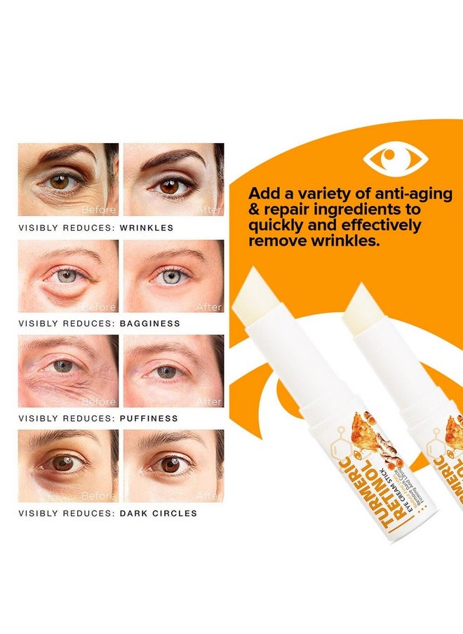 2 PCS Turmeric Retinol Eye Stick,Eye Balm Stick Hydrating for Dark Circle,Wrinkles,Visible Results in 3-4 Weeks,Anti Aging Under Eye,Retinol Eye Cream For Puffiness and Bags Reduces Fine Lines