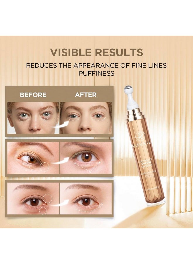 RONKIE Eye Cream Anti Aging: Under Eye Cream with Caffeine Retinol - Reduces Under Eye Bags and Fine Lines Gold