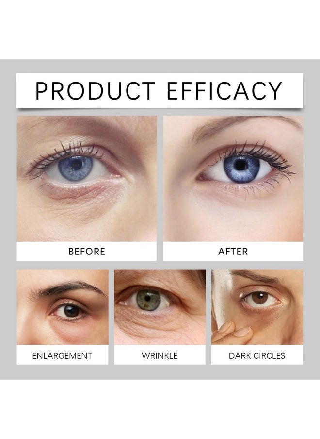 Lumibalm Erases Eye Bags within Minutes, Lumibalm for Under Eye Bags Lumibalm Eye Serum Lumibalm Stick for Under Eye Bags Turmeric Retinol Anti Aging Eye Cream Stick Reduce Fine Lines (1)