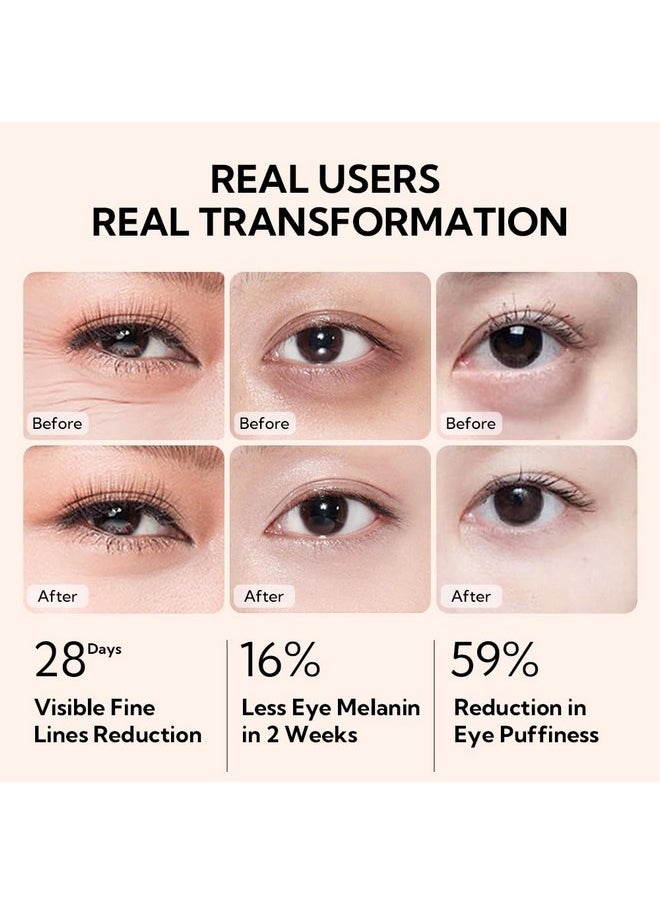 LANBENA Vtamin C Eye Cream for Wrinkles,Under Eye Cream for Dark Circles,Caffeine Eye Cream Anti Aging Brightener,Eye Serum for Women and Man.