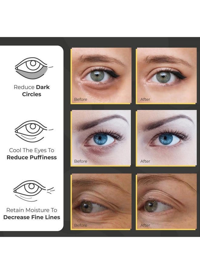 Under Eye Patches for Puffy Eyes and Dark Circles | Infused Gel Mask Patches for Dark Circle Undereye Support of Bags & Puffiness | Ideal for Bridesmaid Gifts & Bachelorette Party | Day and Night