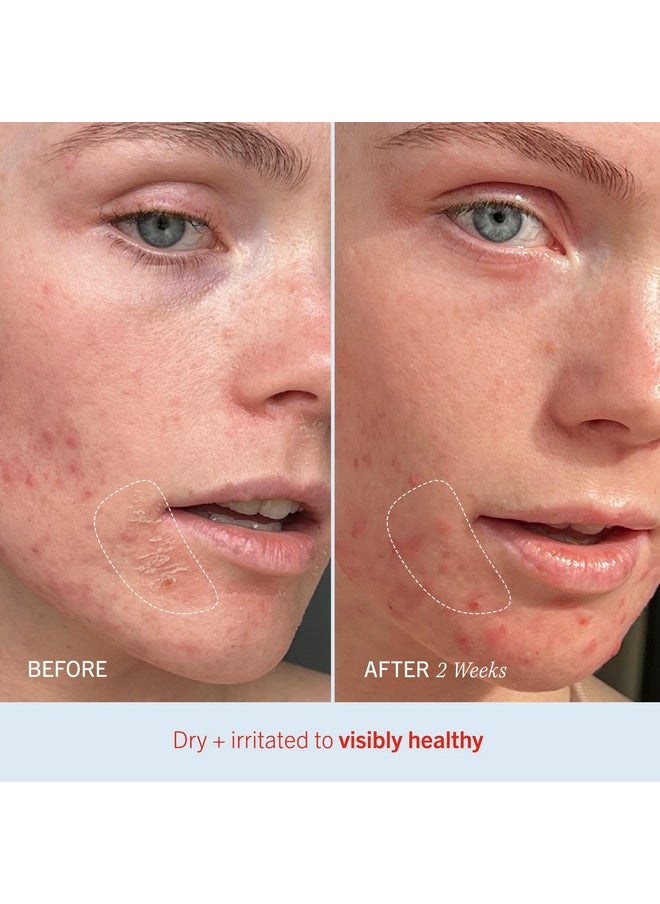 First Aid Beauty - Ultra Repair Cream, Intense Hydration Whipped Colloidal Oatmeal, Clinically Proven to Strengthen Skin Barrier in 7 Days & Helps Relieve Eczema, Luxury Face & Body Moisturizer, 2 oz