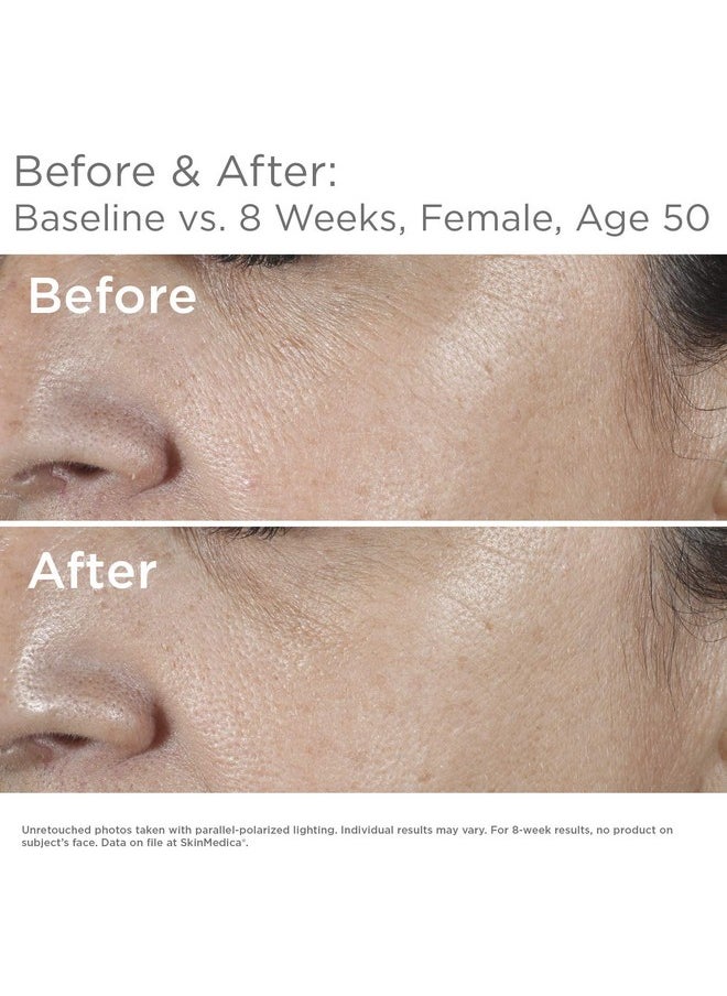 SkinMedica HA5 Rejuvenating Hydrator. Hyaluronic Acid Serum for Face with Five Types of Hyaluronic Acid that Smooth Fine Lines and Wrinkles, For All Skin Types, 1 Oz