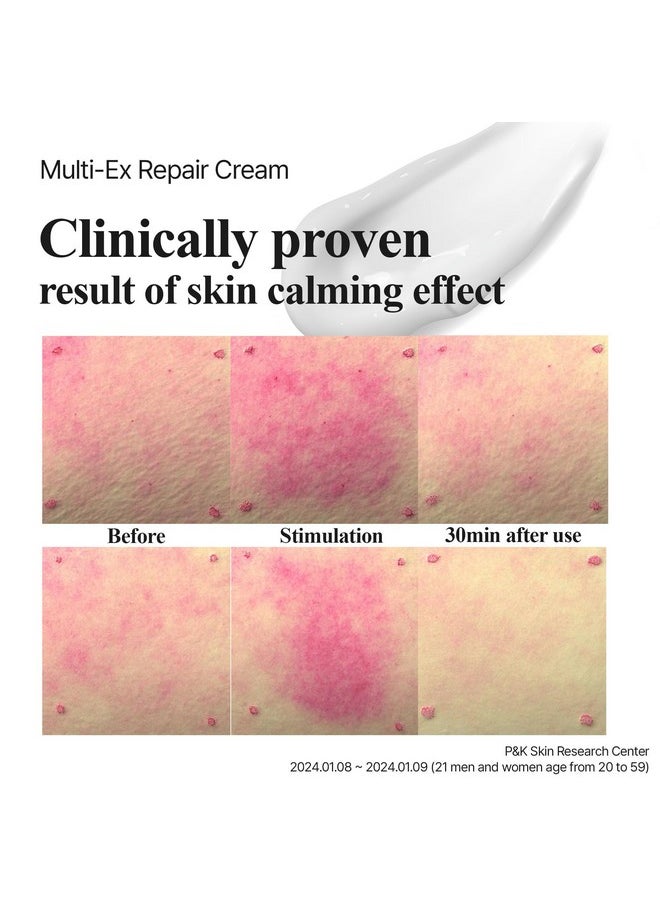 Lab for you] Multi-Ex Repair Cream 50ml/1.69fl.oz | After laser treatment cream | EGF | Soothing Moisturizing Sensitive Skin | Facial Moisturizer | Skin-Relief | Skin Repair Restore