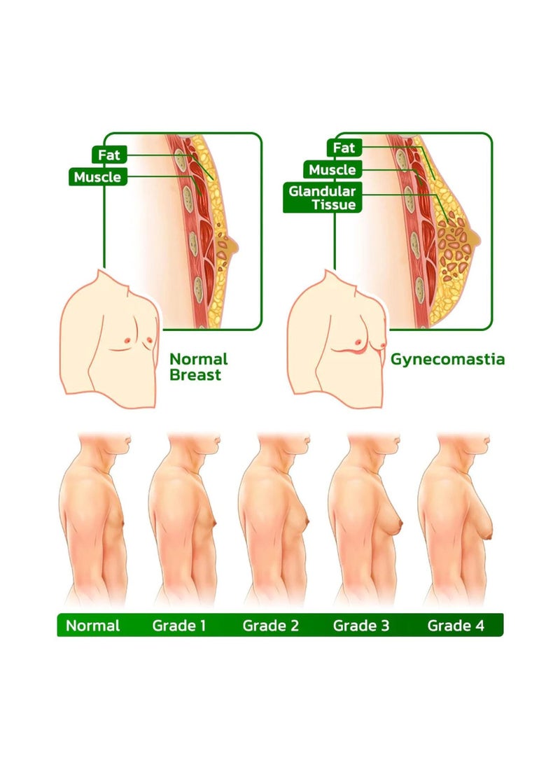 Turmericmax Gynecomastia Chest Compression Patch, Men's Gynecomastia Firming Ginger Patch,  Tightening Chest Muscles with Natural Ingredients, Shrinks Men Chest Tightening Ginger Patch (2 Set)