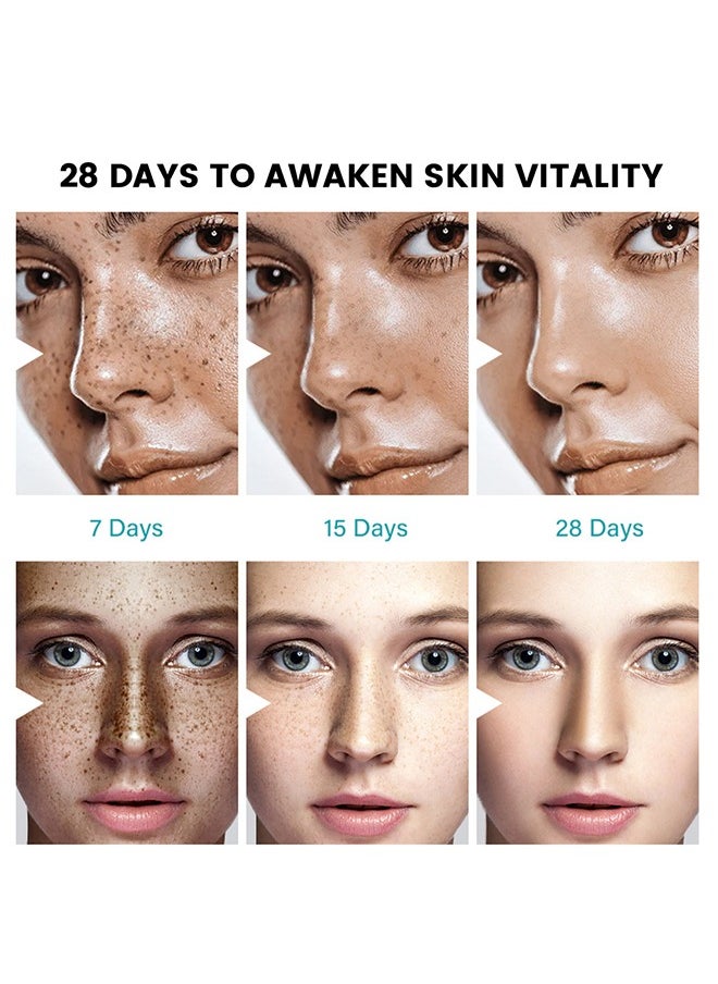 2 PCS Melasma Relief cream Pigmentation Removal Cream for Face, Freckle Remover Cream, Dark Spot Corrector Cream