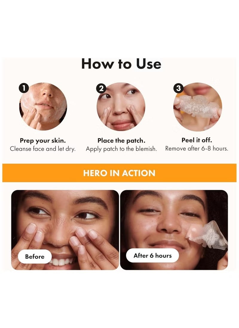 Nose from Hero Cosmetics - XL Hydrocolloid Patches for Nose Pores, Pimples, Zits and Oil - Dermatologist-Approved Overnight Pore Strips to Absorb Acne Nose Gunk (10 Count)