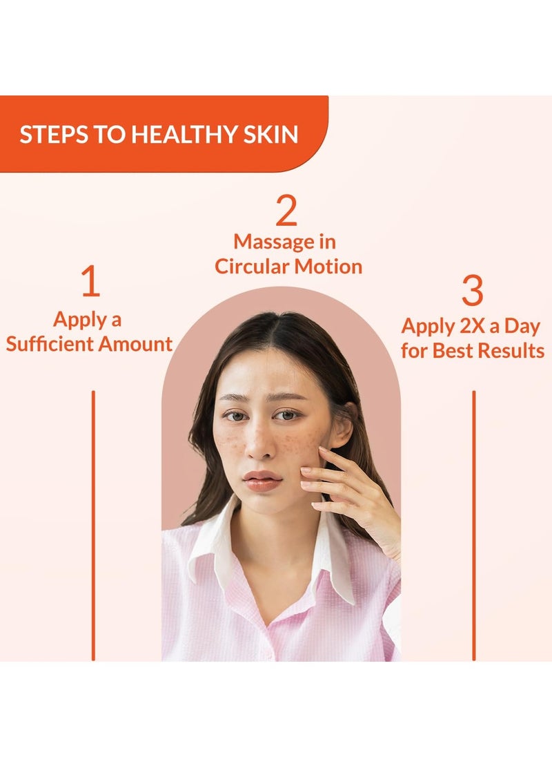 Tranexamic Acid + 2% Kojic Acid + 1% Arbutin SKARFIX -TX Face Cream | Pigmentation Removal Cream | Kojic Acid Cream | Uneven Skin Tone - 30 gm