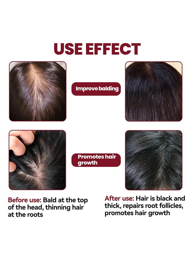 Hair Regeneration Foam For Women, Women's  Foam For Hair Thinning And Hair Loss, Hair Regeneration Foam Revivies And Restores Hair Follicles 60G