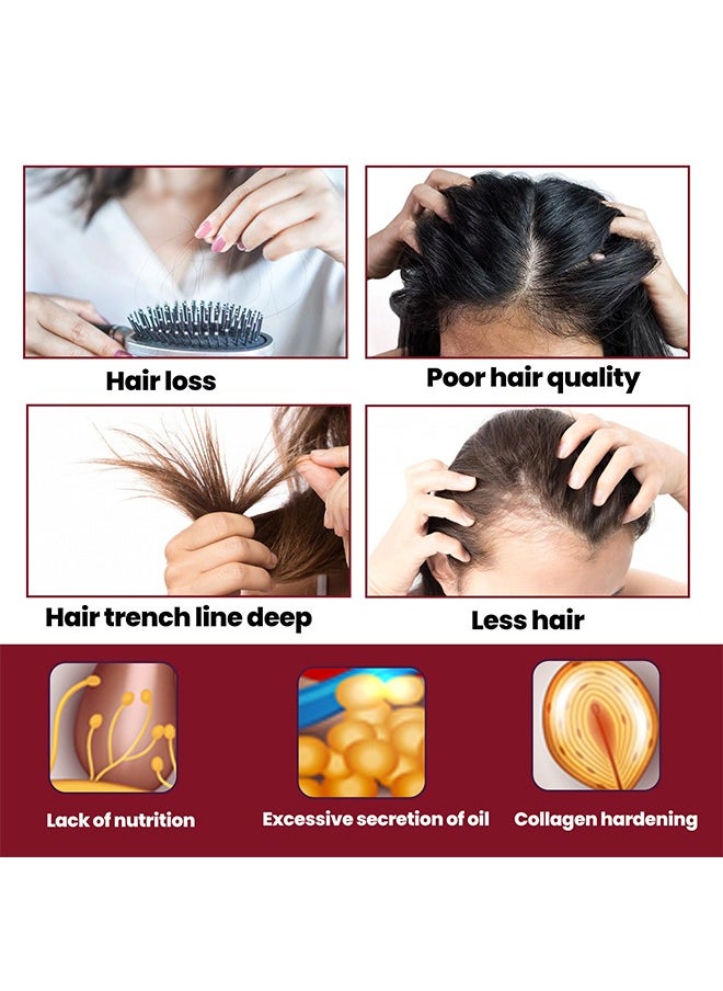Hair Regeneration Foam For Women, Women's  Foam For Hair Thinning And Hair Loss, Hair Regeneration Foam Revivies And Restores Hair Follicles 60G