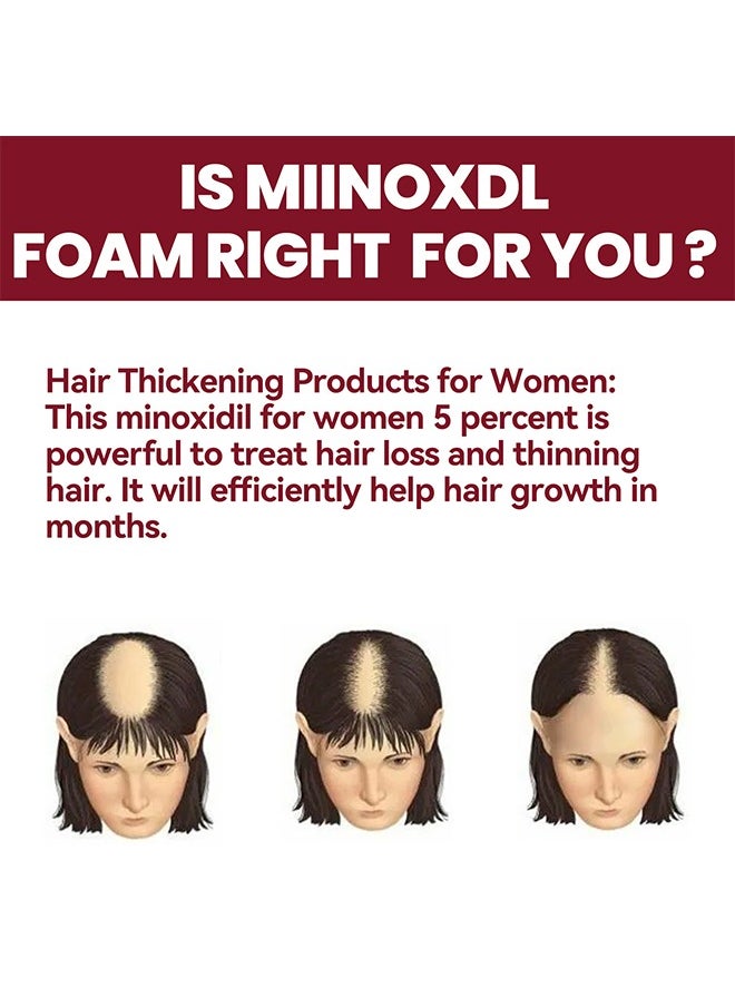 Hair Regeneration Foam For Women, Women's  Foam For Hair Thinning And Hair Loss, Hair Regeneration Foam Revivies And Restores Hair Follicles 60G