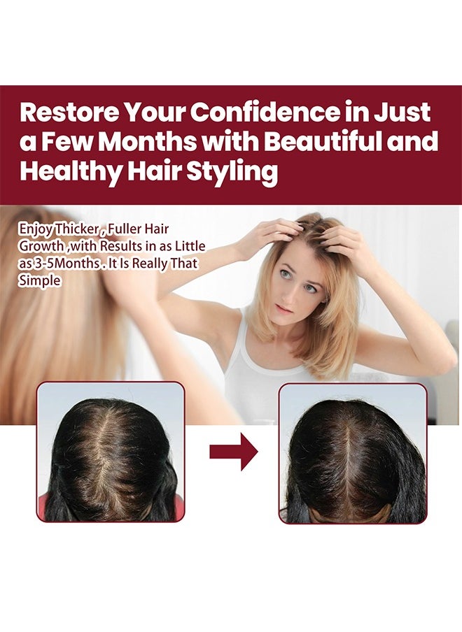 Hair Regeneration Foam For Women, Women's  Foam For Hair Thinning And Hair Loss, Hair Regeneration Foam Revivies And Restores Hair Follicles 60G