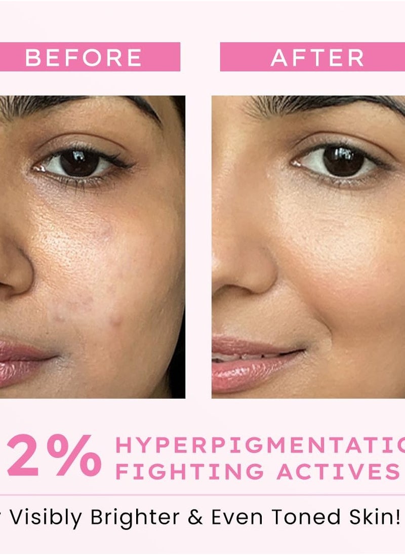 Advanced De-Pigmentation Serum For Hyperpigmentation, Melasma, Dark Spots & Scars With 2% Kojic Acid | Visibly Brightens & Even Tones Skin - 30ml