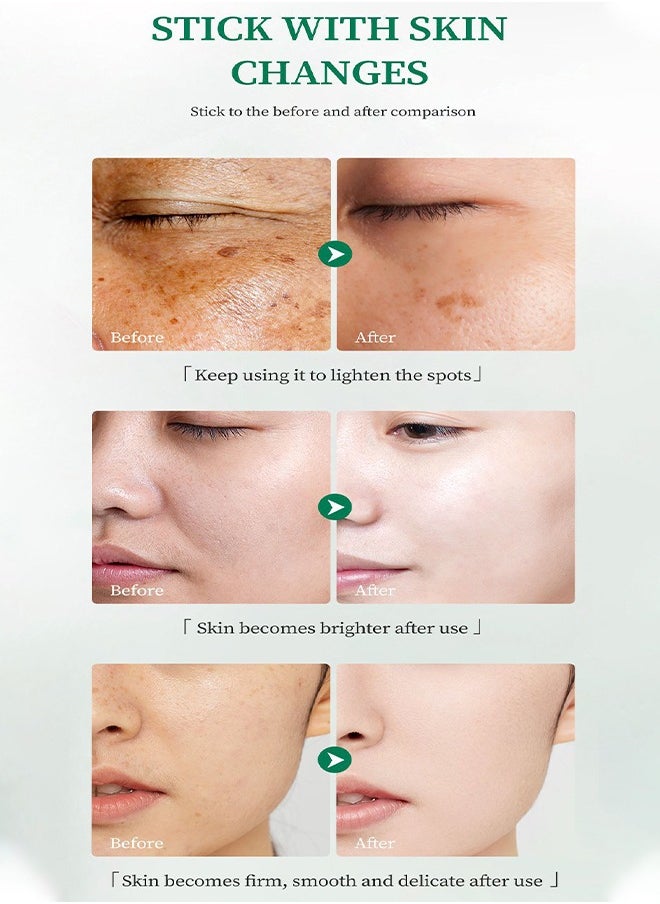 Dark Spots Corrector Cream - Skin Whitening Cream with Vitamin C&B5&E,Keep Moisturizing,Skin Lightening Cream for Intimate Areas and Bleaching,Dark Spot Remover for Face,Neck,Armpit,Elbow, Inner Thigh and Knees