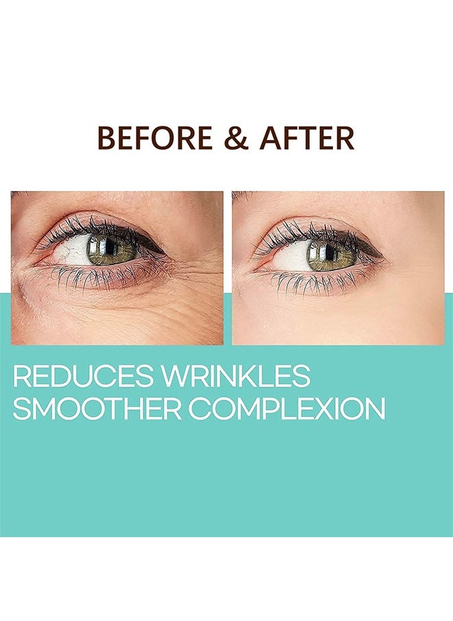 Caffeine Eye Cream,Under for Dark Circles and Puffiness， With Reduce Wrinkles Fine Lines， Bags under eyes Crows Feet Eye Lift Treatment For Women and Men（30ml）
