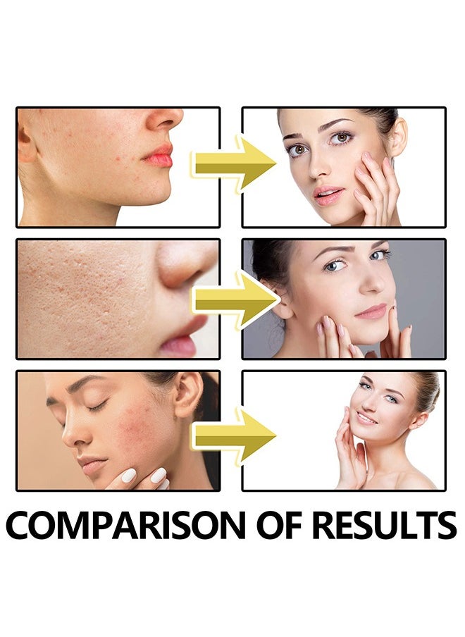 Bee Venom Night Gel,Anti-Aging Bee Venom Facial Gel Moisturizer,Anti-Wrinkle Cream,Firming Face Cream,Facial Moisturizer with Collagen and Hyaluronic Acid,Anti-Wrinkle Reduce Fine Lines