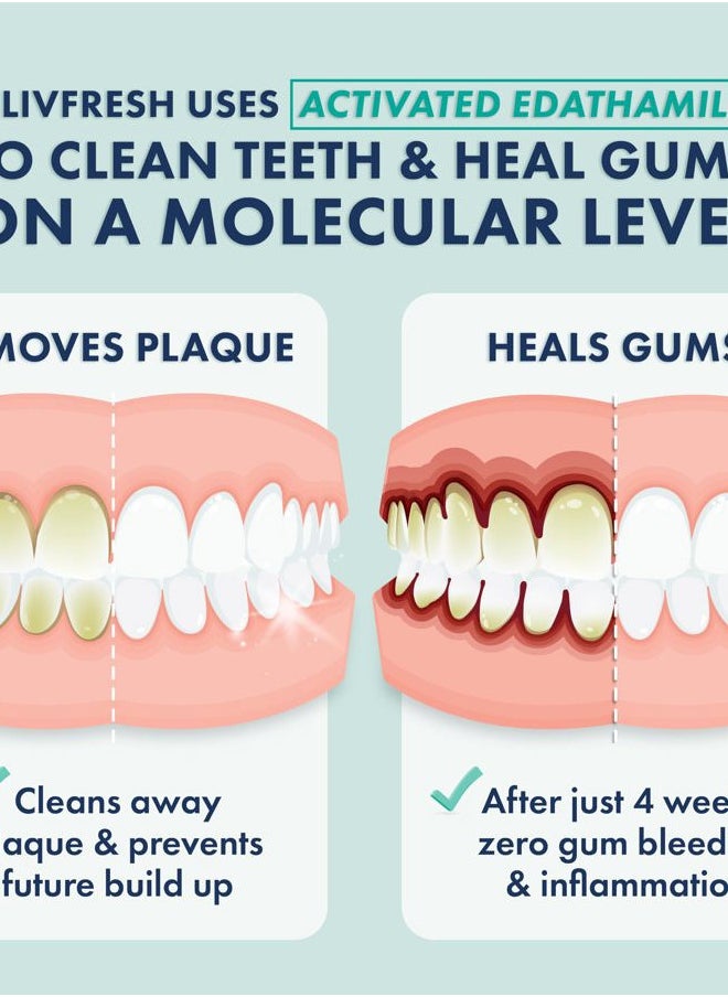 Toothpaste Gel, Clinically Proven to Remove Plaque 250% Better, Improves Gum Health 190% Better, Prevents & Reduces Tartar, Freshens Breath, SLS Free Dental Gel, Wintergreen