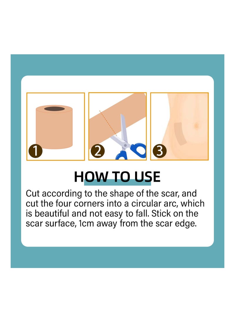 1Pcs Scar Sheets, Scar Tape Roll (1.96in x 196in Roll) - Extra Long Scar Strip for various scars - Waterproof and Cutable Scar Cover Sheets - Skin Tone Scar Patches