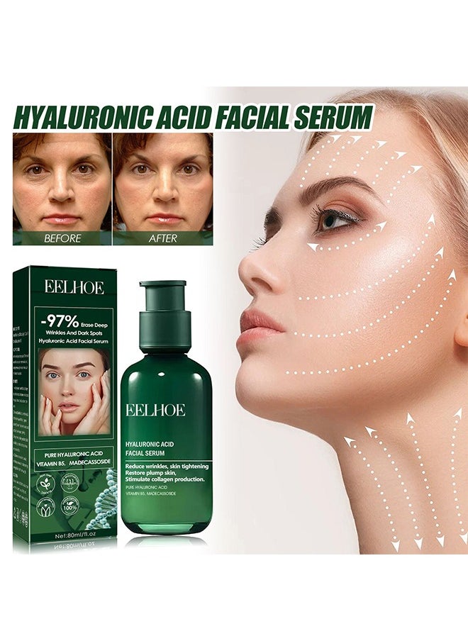 Hyaluronic Acid Facial Serum,Skin Firming Rejuvenating Serums Skin Firming Serums for Face and Neck Skin Firming Serums Skin Firming Serum for Face and Neck for All Skin Types 80ml