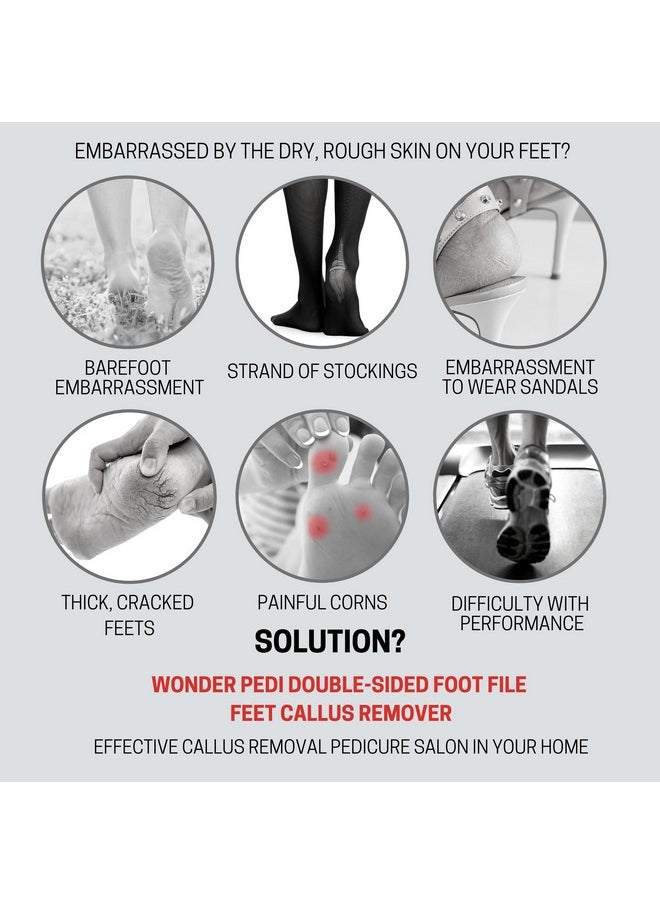 Made in Germany Double Sided Metal Foot File - Stainless Steel Feet Callus Remover - Feet Scrubber Dead Skin - Heel Scraper Cracked Heels Repair Professional Foot Rasp.
