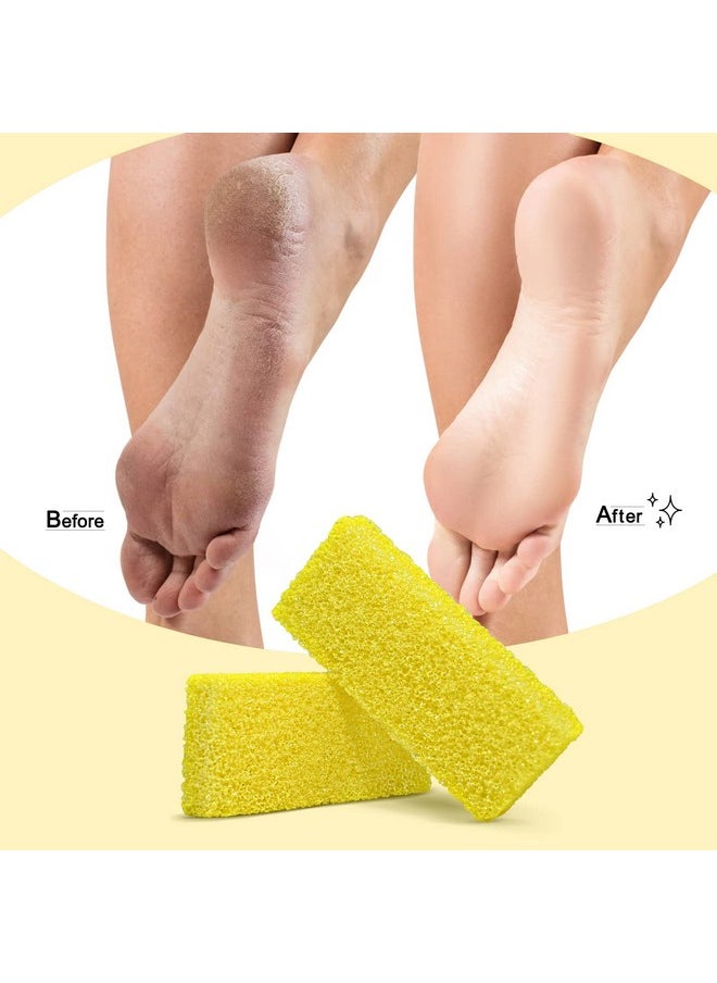 Disposable Foot Scrubber Sponge Pads Pedicure Pumice Stone for Feet Callus Remover Medium Coarse Yellow 40Pcs