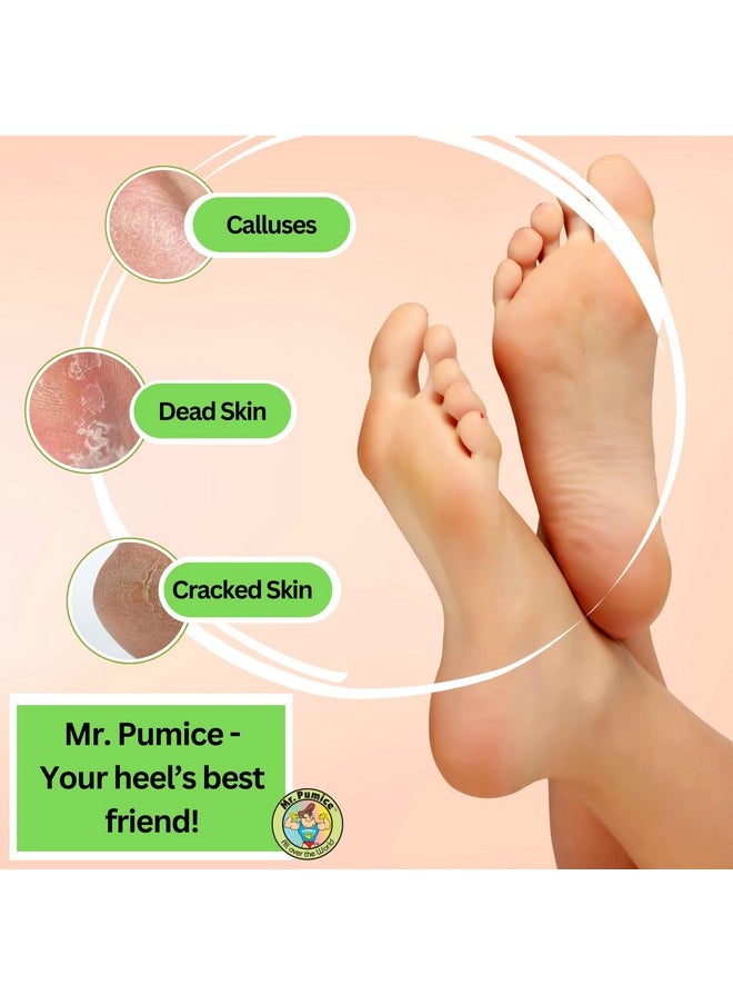 Mr. Pumice Callus Remover PUMI Bar: Pedicure Stone & Foot Scrubber - Medium Grit (Assorted Colors) 24 Pack Display Case