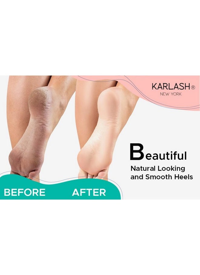 Professional Best Callus Remover Gel for Feet and Foot Pumice Stone Scrubber Kit Remove Hard Skins Heels and Tough Callouses from feet Quickly and Effortless 4 oz (1 Bottle)