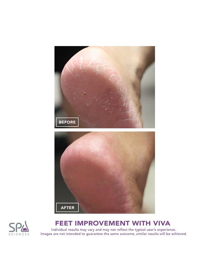 Spa Sciences Viva Most Powerful Pedicure Tool Available-Professional Electronic Foot Smoothing Pedi Tool for Removing Hard, Dry, Cracked Skin/Calluses on Feet, Rechargeable-2 Treatment Heads Included