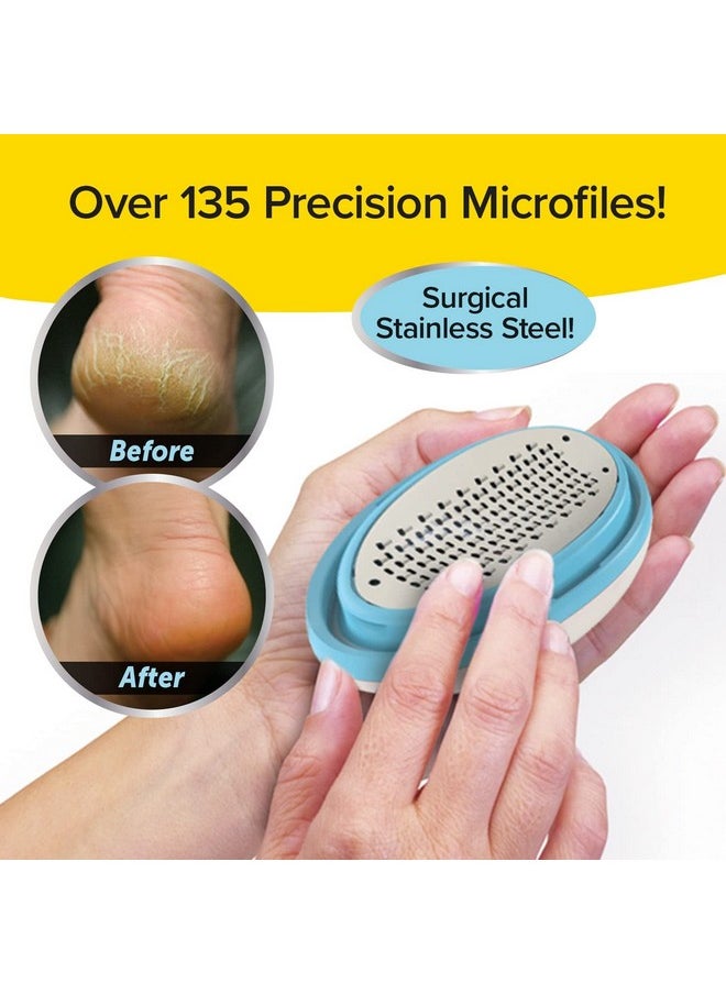 PedEgg Classic Callus Remover, As Seen On TV, New Look, Safely and Painlessly Remove Tough Calluses & Dry Skin to Reveal Smooth Soft Feet, 135 Precision Micro-Blades, Traps Shavings Mess-Free